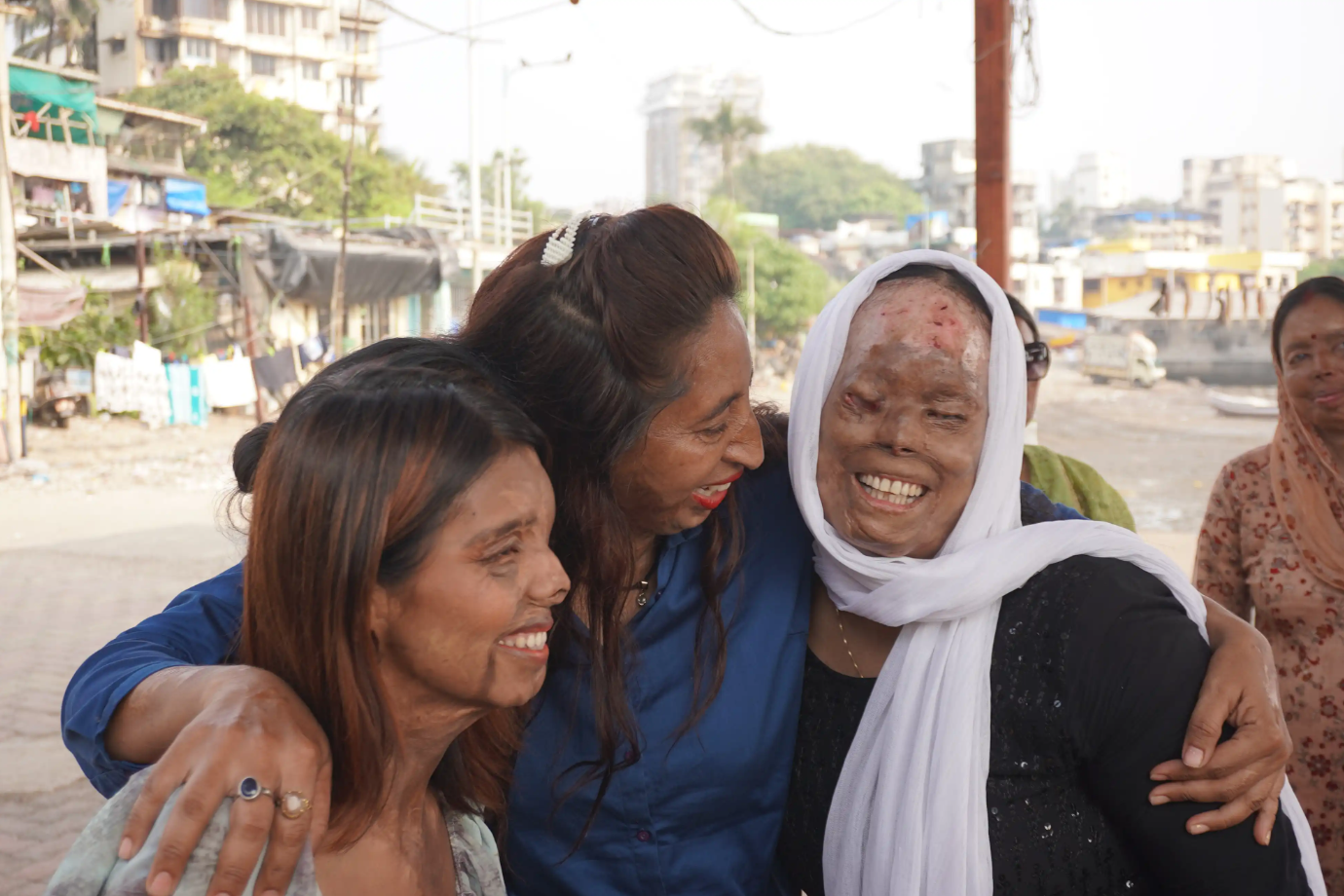 the founder of Saahas Foundation with acid attack survivors
