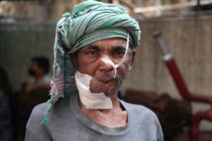 an elderly man with medical gauze 