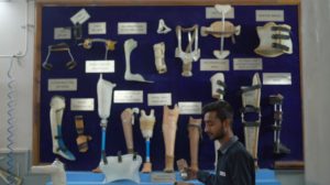 prosthetics displayed on a wall